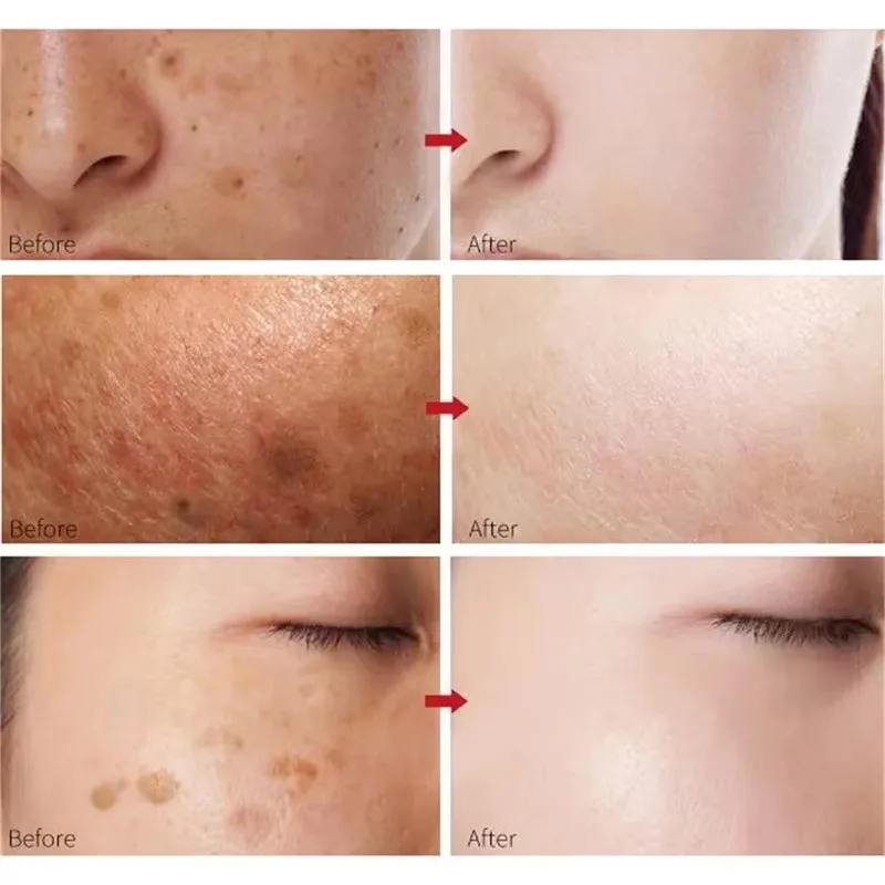 Peach 70% Niacinamide Serum 30Ml Moisturizing Prevent Dryness Facial Essential Oil Increasing Elasticity Smooth Soften Skin Care - Image 5