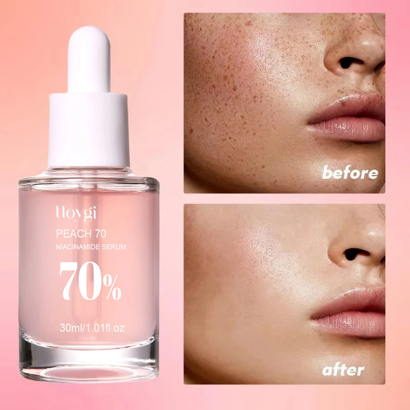 Peach 70% Niacinamide Serum 30Ml Moisturizing Prevent Dryness Facial Essential Oil Increasing Elasticity Smooth Soften Skin Care - Image 6