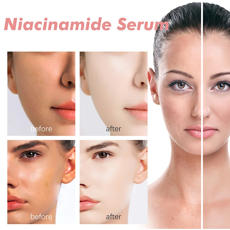 Peach 70% Niacinamide Serum 30Ml Moisturizing Prevent Dryness Facial Essential Oil Increasing Elasticity Smooth Soften Skin Care - Image 4