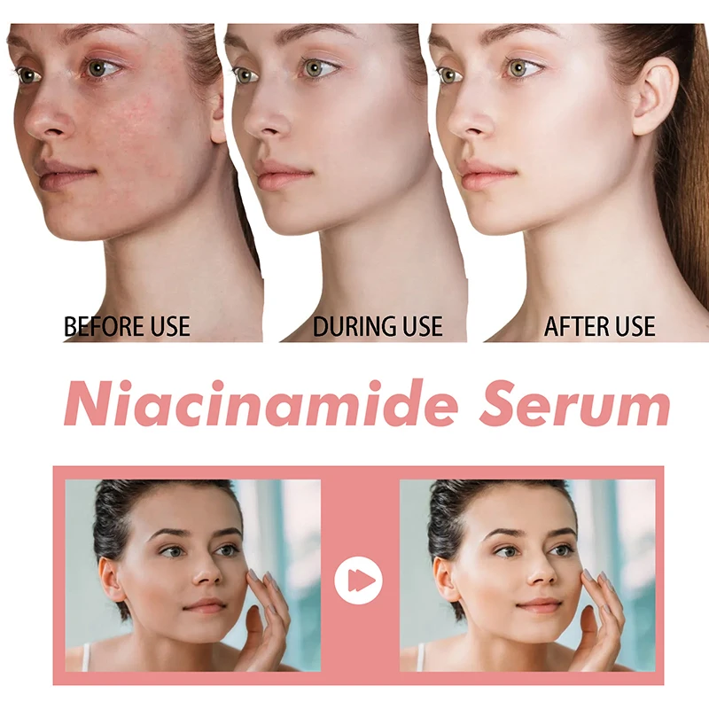 Peach 70% Niacinamide Serum 30Ml Moisturizing Prevent Dryness Facial Essential Oil Increasing Elasticity Smooth Soften Skin Care - Image 3