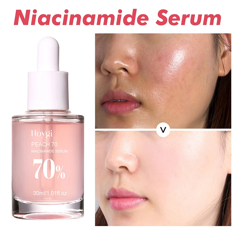 Peach 70% Niacinamide Serum 30Ml Moisturizing Prevent Dryness Facial Essential Oil Increasing Elasticity Smooth Soften Skin Care - Image 2